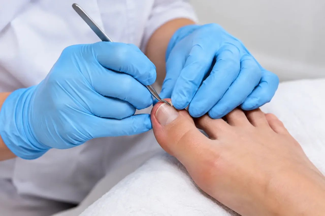 Does Nail Surgery Hurt? A Clear Guide to Treatment